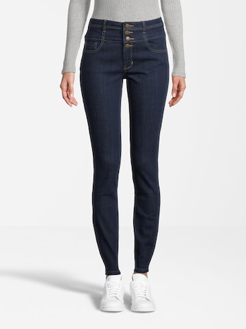 Orsay Slimfit Jeans in Blau: predná strana