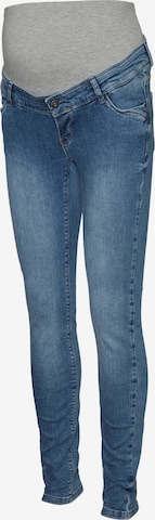 Skinny Jeans 'Desota' de la MAMALICIOUS pe albastru: față