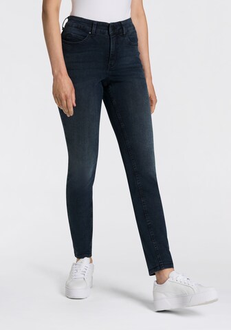 MAC Skinny Jeans in Blau: Vorderseite