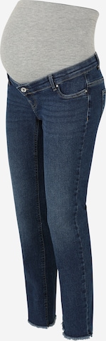 Only MaternitySlimfit Traperice 'OLMBilly' - plava boja: prednji dio