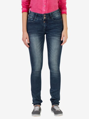 TIMEZONE Skinny Jeans in Blauw: voorkant