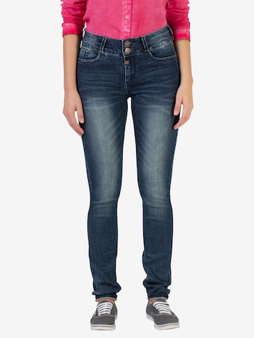 TIMEZONE Skinny Jeans in Blauw: voorkant