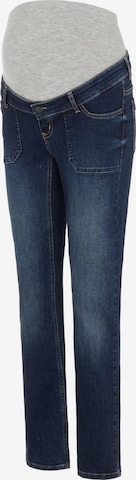 MAMALICIOUS Slimfit Jeans 'Sanne' in Blau: predná strana