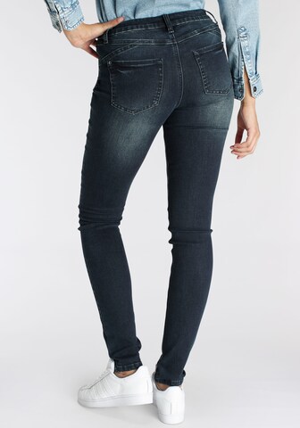 ARIZONA Skinny Jeans 'Arizona ' in Blau: predná strana