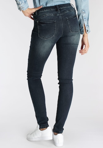 ARIZONA Skinny Jeans 'Arizona ' in Blue: front