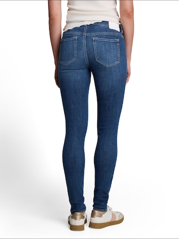Skinny Jeans di TOM TAILOR DENIM in blu
