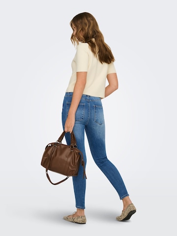 ONLY Skinny Jeans 'ONLMila' i blå