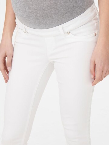 Only Maternity Skinny Jeans in Weiß