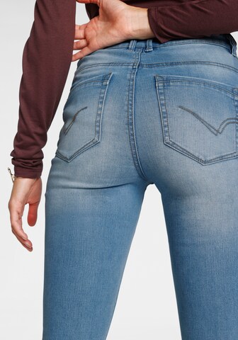 ONLY Slimfit Jeans in Blau