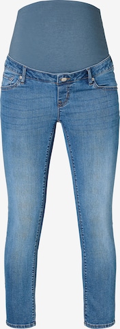 Coupe slim Jean 'Mila' Noppies en bleu : devant