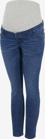 MAMALICIOUS Slimfit Jeans 'Sarnia' i blå: framsida
