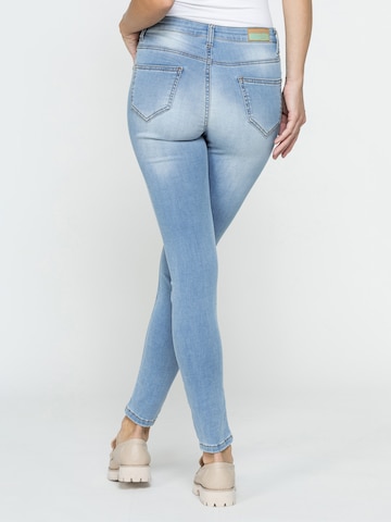 Carrera Jeans Skinny Jeans '5-Pocket Legg'‌‌‌‌‌‌‌ in Blau