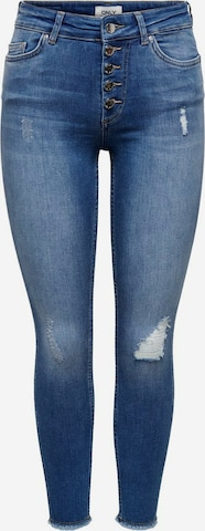 ONLY Skinny Jeans 'Bobby' in Blau: predná strana