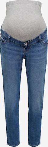 Only Maternity Regular Jeans 'OLMCatwalk' in Blue: front