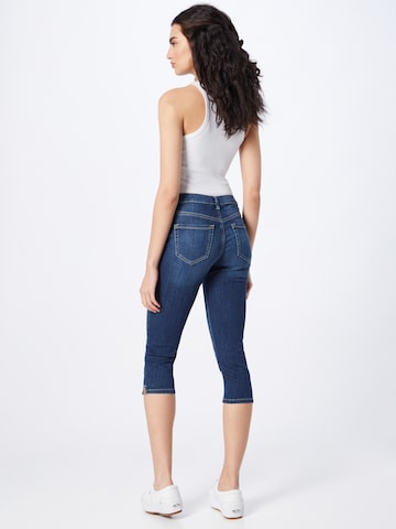 TOM TAILOR Skinny Jeans 'Kate' in Blauw