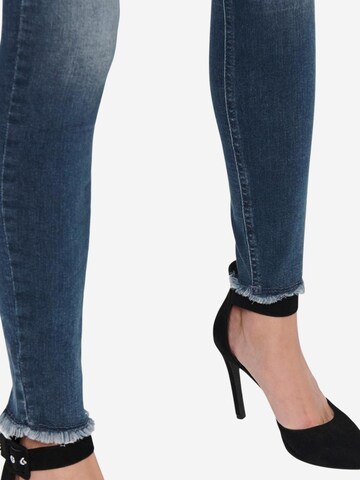 Skinny Jeans 'ONLBLUSH MID SK ANK RW REA422 NOOS 15216970' di ONLY in blu