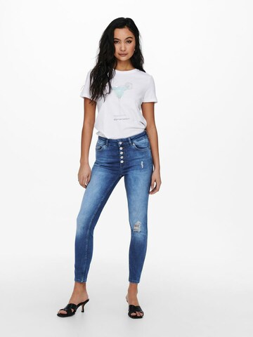 ONLY Skinny Jeans 'Bobby' in Blauw