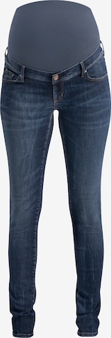 Noppies Skinny Jeans 'Avi' in Blauw: voorkant