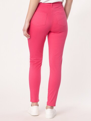 Skinny Pantaloni di Quiosque in rosa