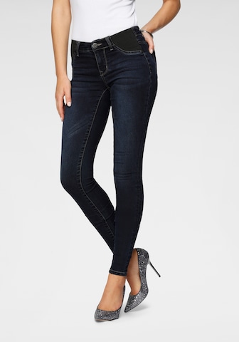 ARIZONA Skinny Jeans in Blue: front