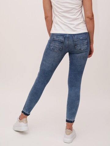 Miracle of Denim Skinny Jeans 'Suzy' in Blauw
