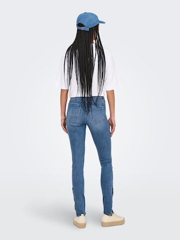 Slimfit Jeans 'ONLWINNIE' di ONLY in blu