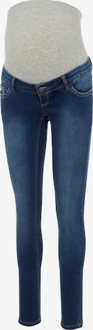 MAMALICIOUS Slimfit Jeans 'Mllola' in Blauw: voorkant