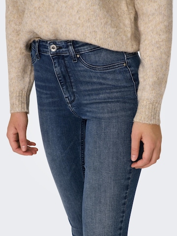 ONLY Skinny Jeans 'FOREVER' in Blauw