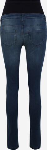 Envie de Fraise Skinny Jeans 'CLINT' i blå