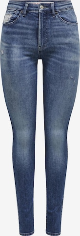 Skinny Jeans 'TRAVIS' di ONLY in blu: frontale