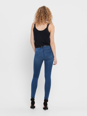 Skinny Jeans 'ROYAL' de la ONLY pe albastru