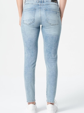 M.O.D MIRACLE OF DENIM Skinny Farmer - kék