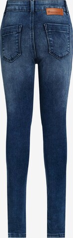 WE Fashion Skinny Jeans in Blauw