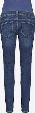 MAMALICIOUS Regular Jeans 'BETTY' in Blau
