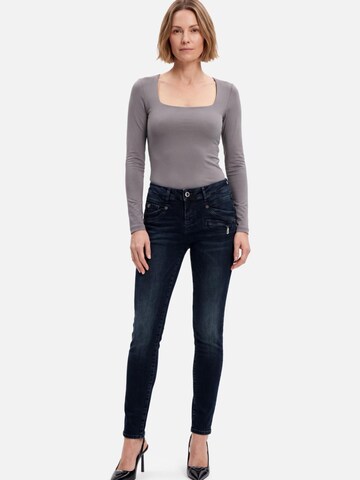 M.O.D MIRACLE OF DENIMSkinny Traperice - plava boja: prednji dio