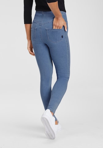 ARIZONA Skinny Jeggings in Blau