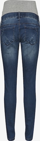 MAMALICIOUS Skinny Jeans 'Jackson' in Blue