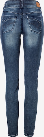 Skinny Jeans di TIMEZONE in blu