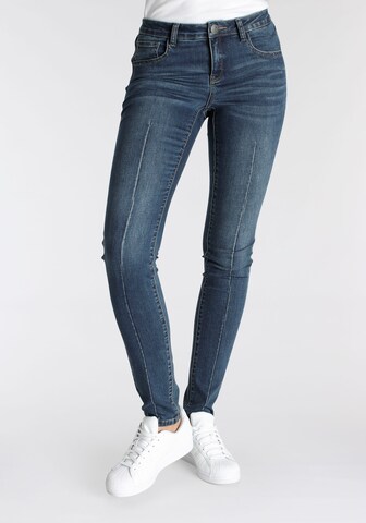 ARIZONA Skinny Jeans 'Arizona ' in Blue: front