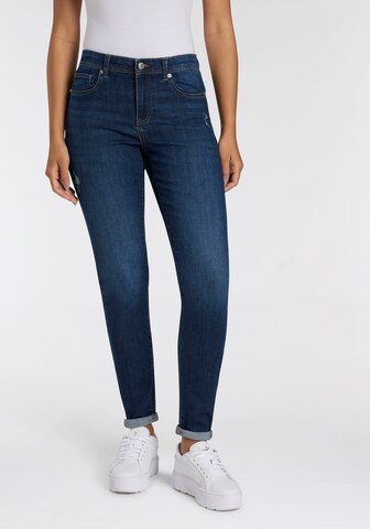 ONLY Skinny Jeans in Blau: Vorderseite