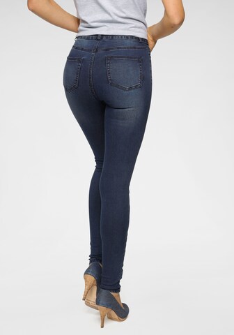 ARIZONA Skinny Jeans in Blau