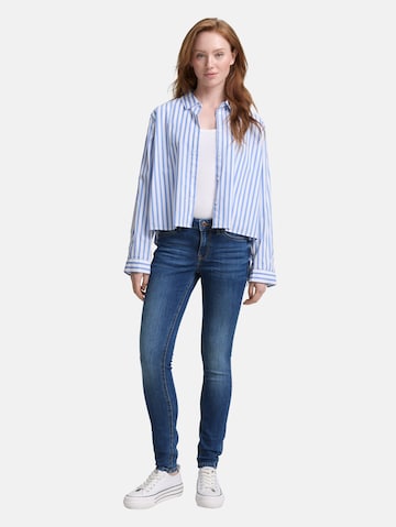 TOM TAILOR DENIM Skinny Jeans in Blauw: voorkant