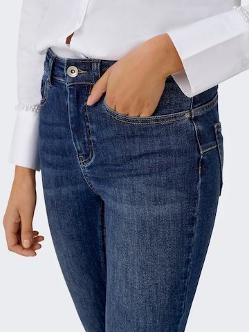 ONLY Skinny Jeans in Blau
