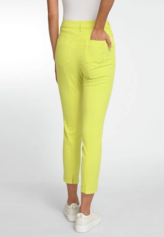 Skinny Jean Basler en jaune