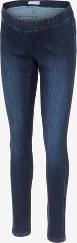 MAMALICIOUS Slimfit Jeggings 'Lola' in Blau: predná strana