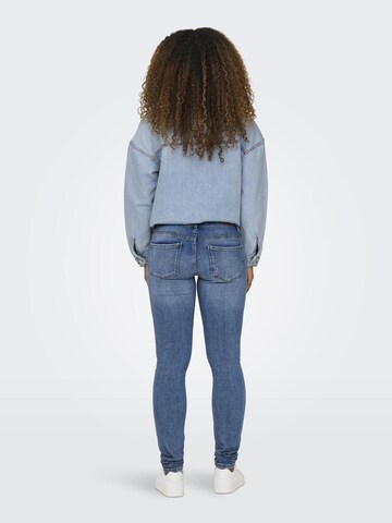 ONLY Slimfit Jeans 'CORAL' in Blau