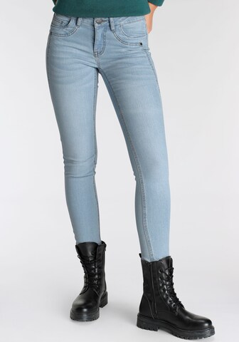 ARIZONA Skinny Jeans in Blue: front