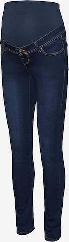 Skinny Jeans 'MLKAIRO' de la MAMALICIOUS pe albastru: față