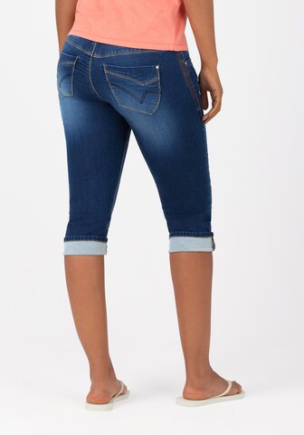 TIMEZONE Slimfit Jeans 'Enya' in Blauw