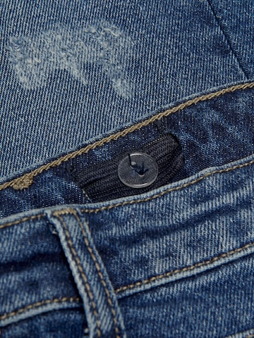 ONLY Baggy Jeans 'Calla' in Blue